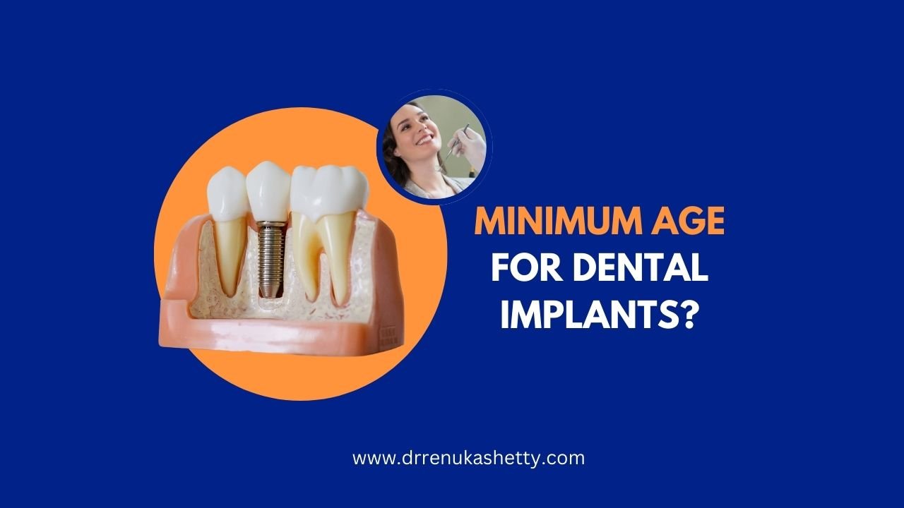 Does Age Matter When Getting a Dental Implant?